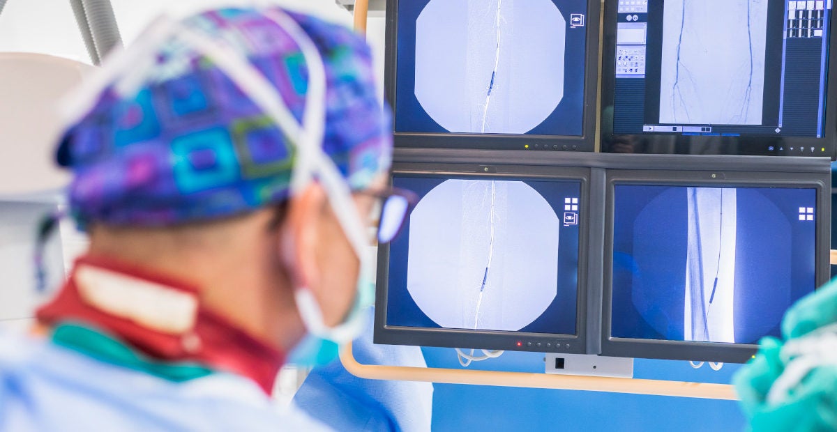 ¿Qué es la radiología intervencionista? ¿Cuáles son sus etapas? ¿Qué es la radiología intervencionista? ¿Cuáles son sus etapas?